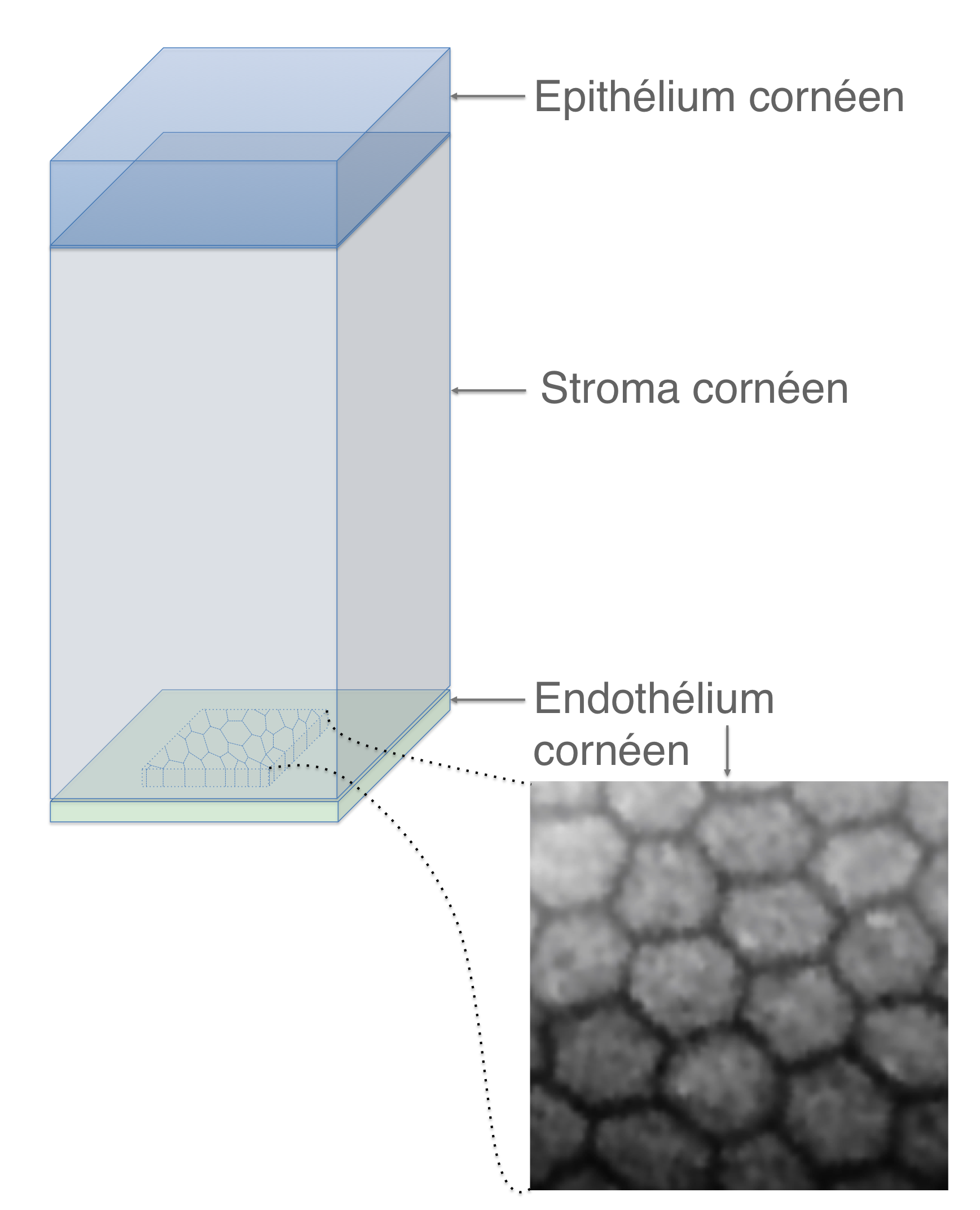 analyse par microscopie spéculaire de l'endothélium, la couche la plus profonde de la cornée