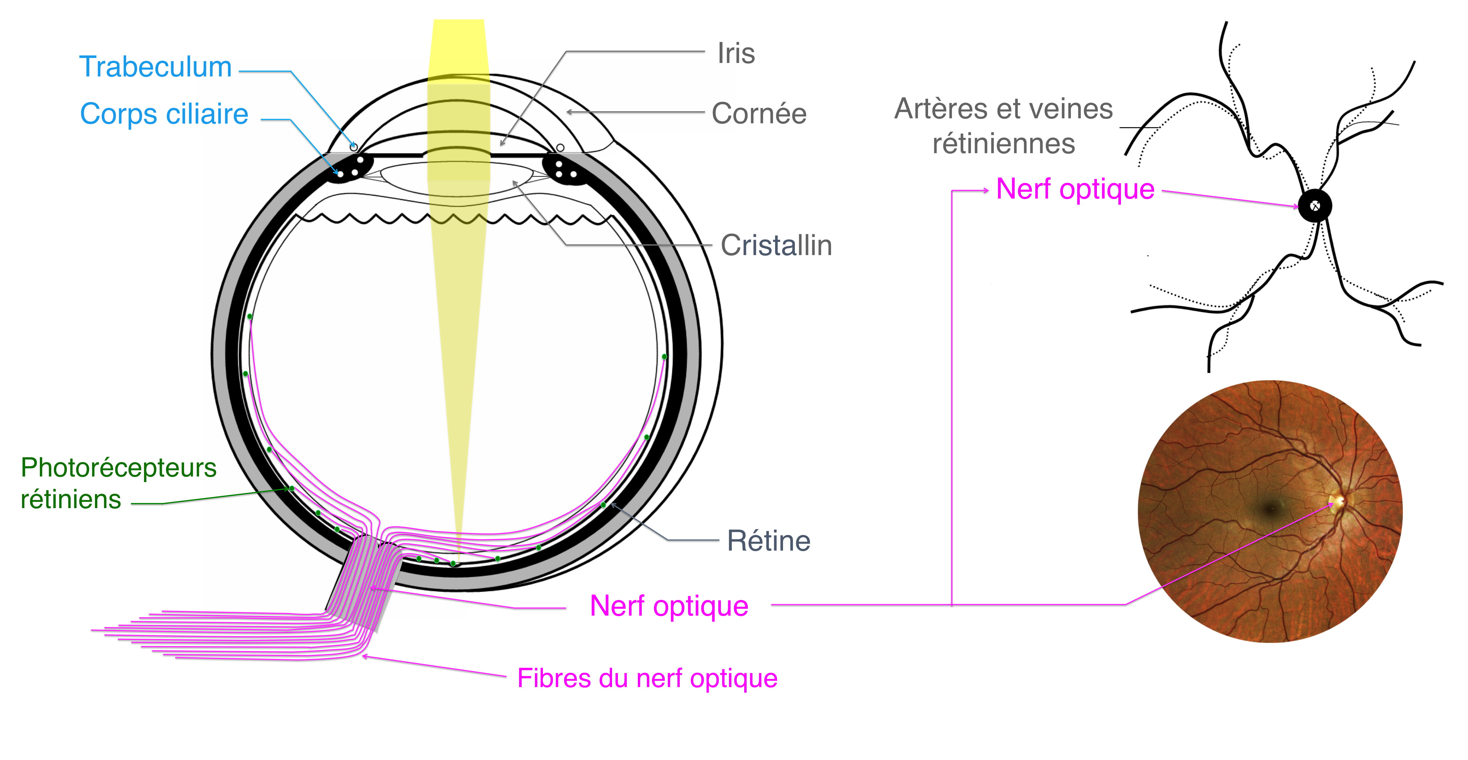 hypertonies intra oculaires et glaucomes : bases anatomiques