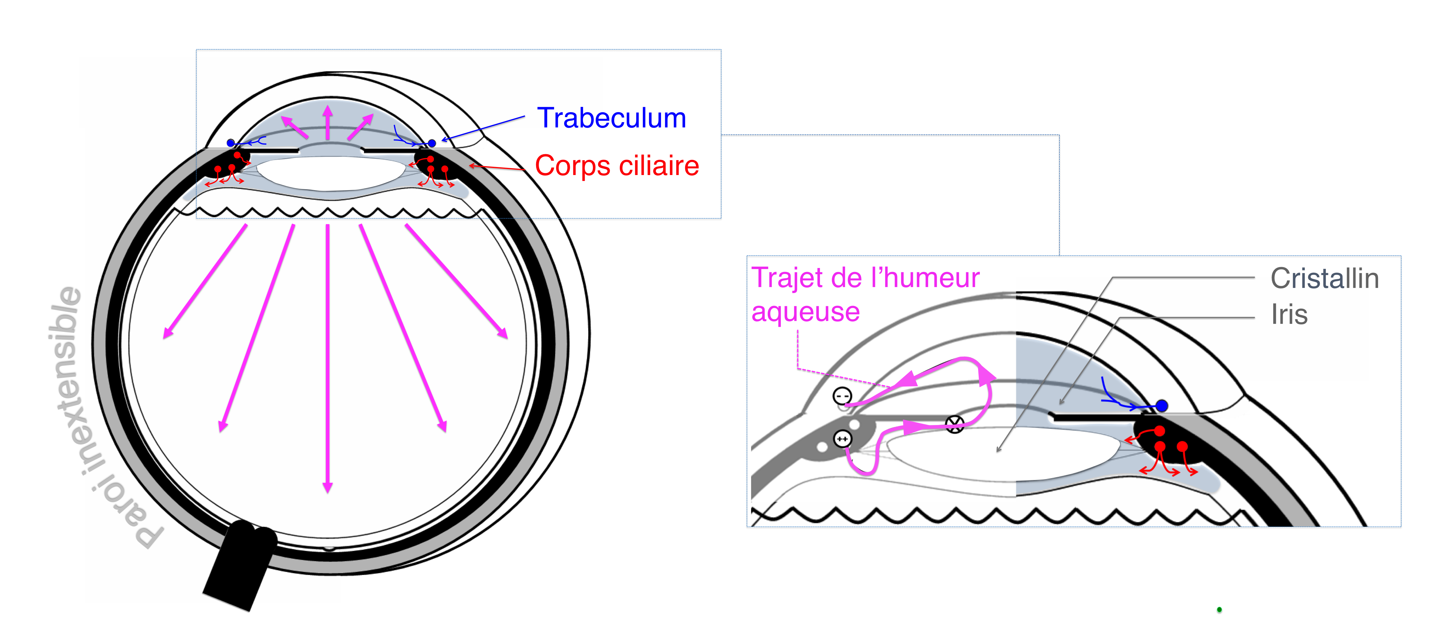 Pathologies oculaires - Les hypertonies intra oculaires et les ...