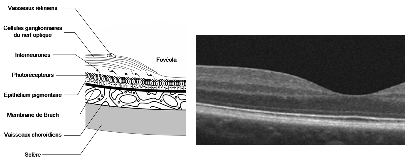 Coupe OCT de la rétine maculaire normale