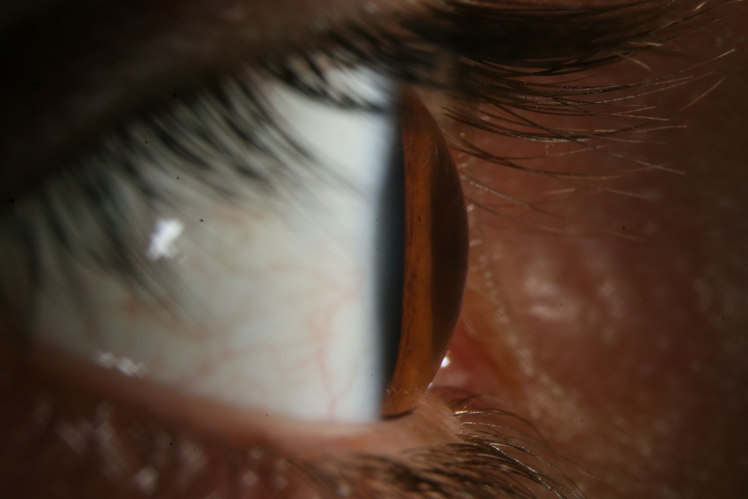 La sclère correspondant au blanc de l'oeil vue de profil