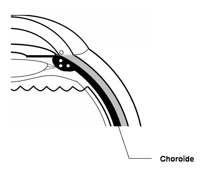 La choroïde visible sur la coupe du globe oculaire