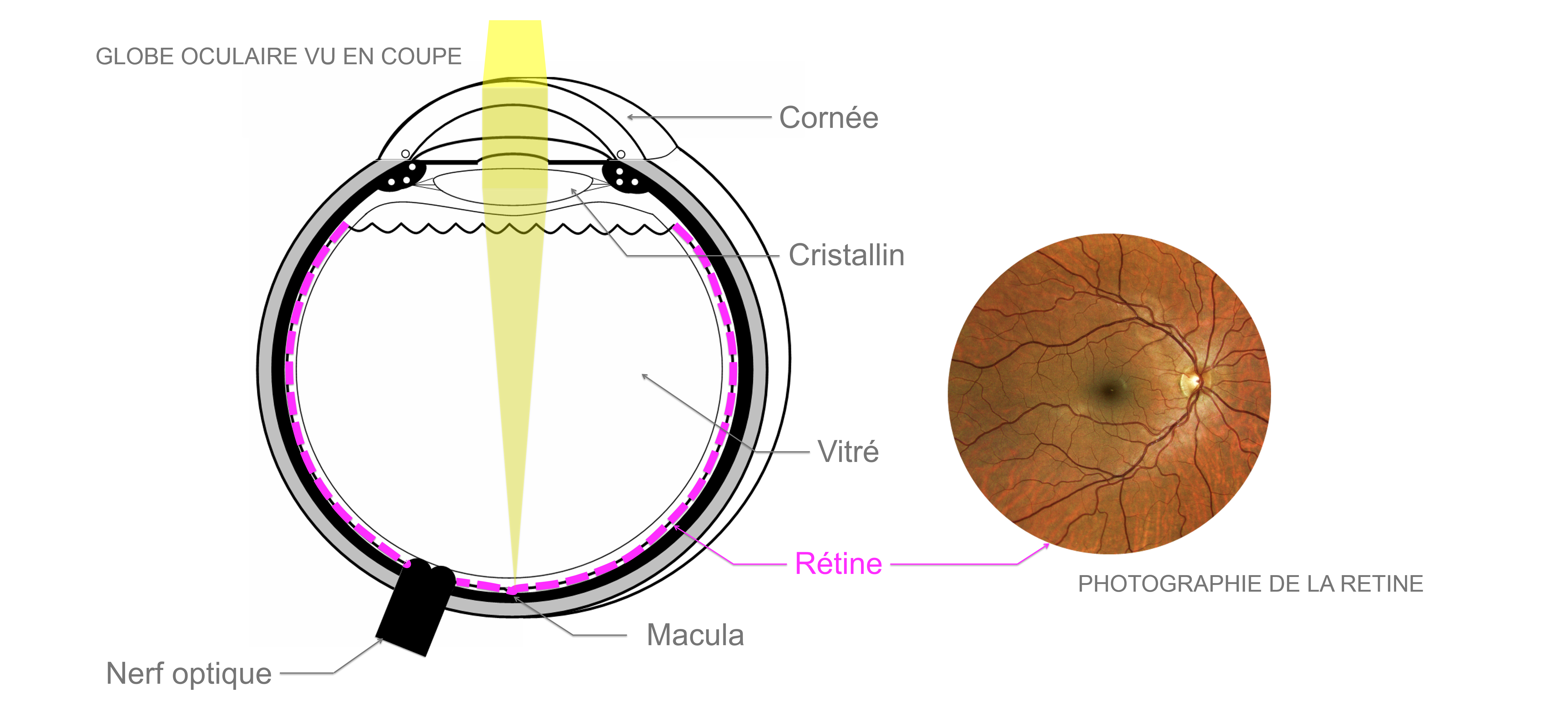 déchirure rétinienne : anatomie de la rétine