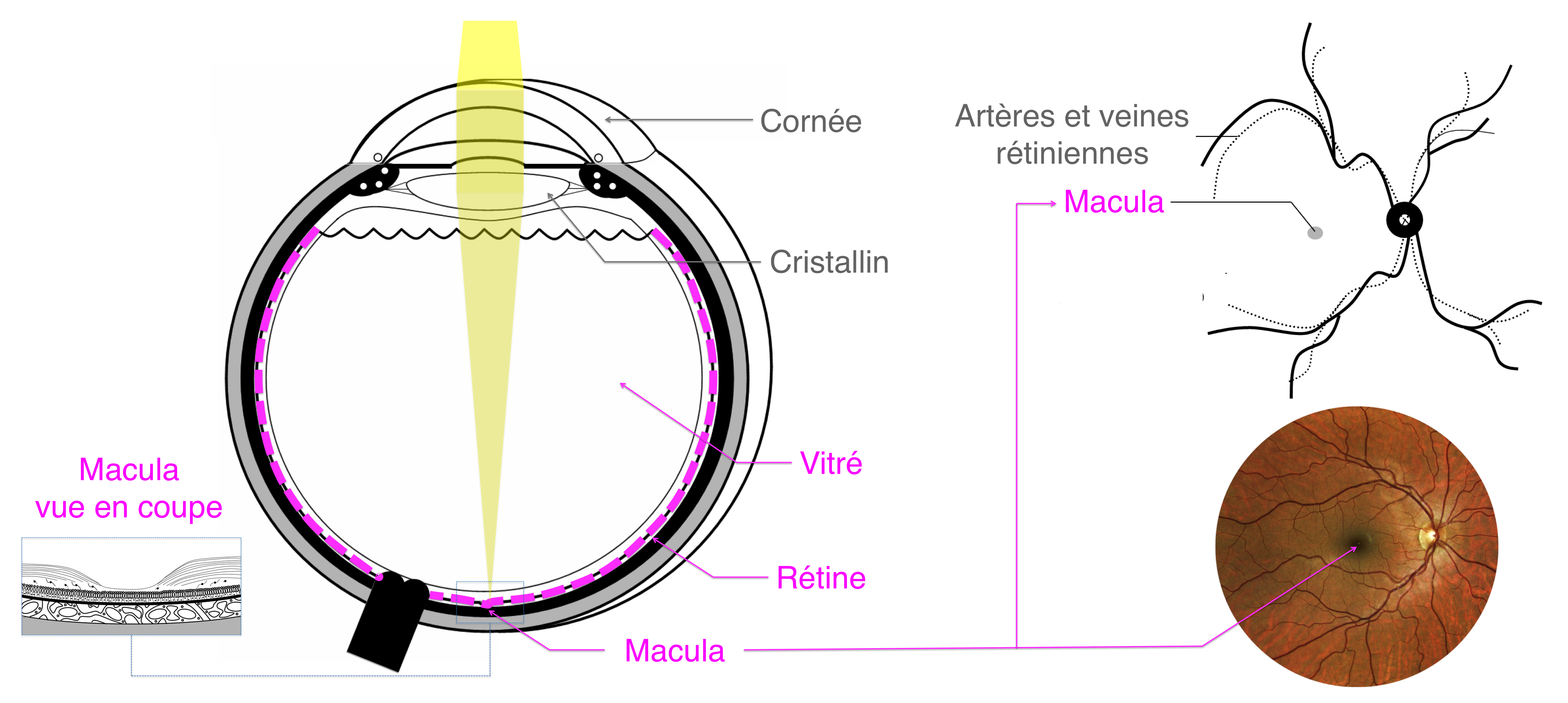 membrane épi-rétinienne : anatomie de la rétine et de la macula