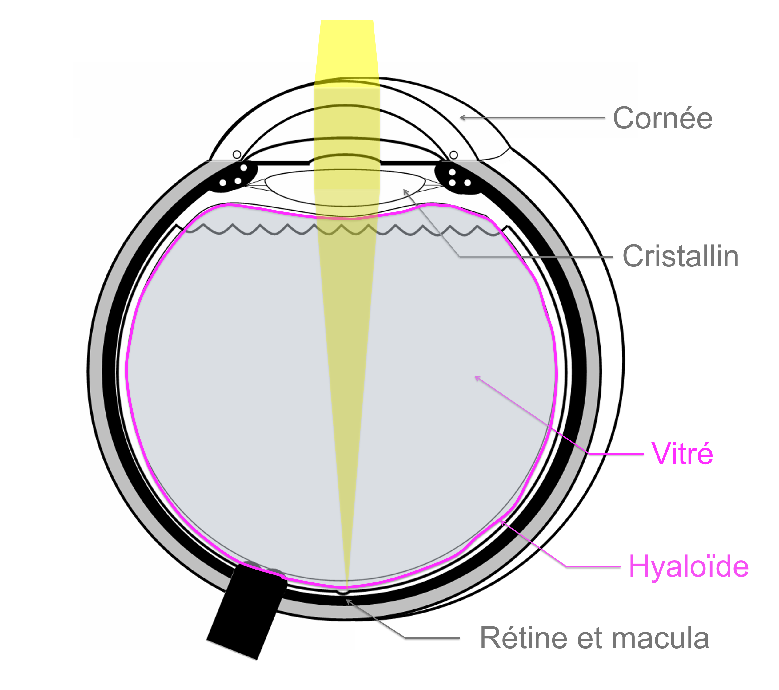 anatomie de l'oeil : le vitré et la hyaloïde dont le détachement de la rétine est à l'origine du décollement postérieur du vitré